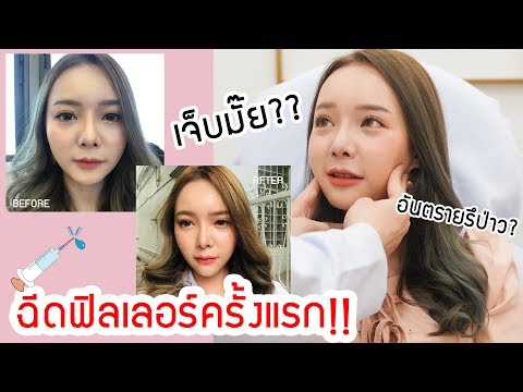 เมโสแฟต ยี่ห้อไหนดี