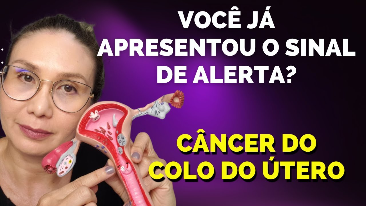 CÂNCER DO COLO DO ÚTERO, SINAL DE ALERTA!