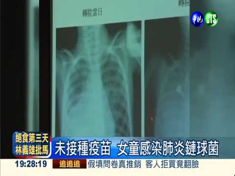 最強肺炎鏈球菌 一歲娃4天猝死