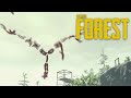 MY FIRST ENCOUNTER WITH THE WORM HILARIOUS The Forest