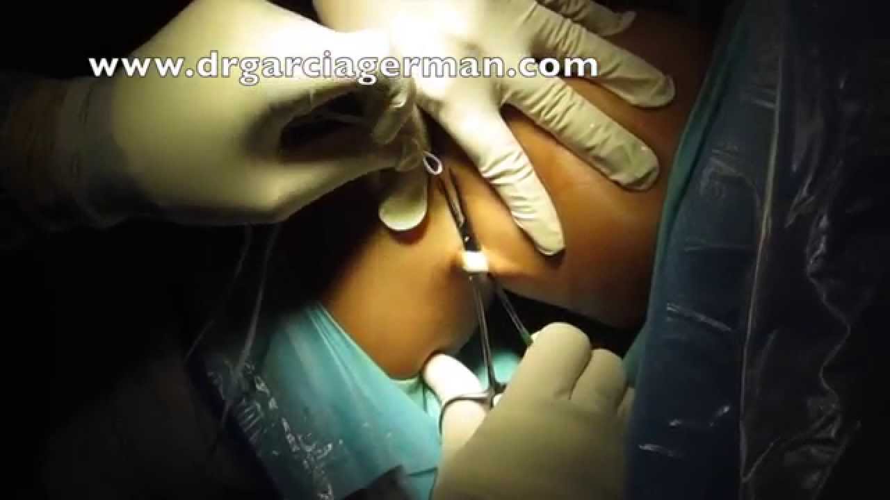 Diego García-Germán Vázquez-24