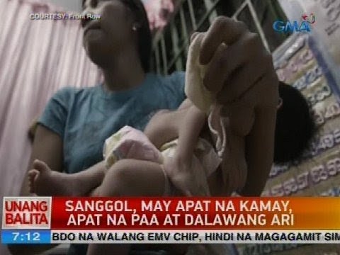 Mustasa slimming Pinakuluang repolyo diyeta mga review at mga resulta
