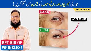 Remove Face Wrinkles Permanently - Jhuriyan Khatam Karne Ka Tarika - Anti-Aging Cream? Urdu/Hindi