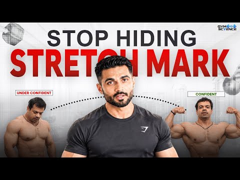 Stretch Marks Ke Baare Mein Sabse Bade Myths + Body Confidence Kaise Banaye