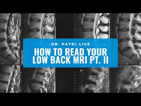 Dr. Patel LIVE: Low Back MRI Tutorial Part II