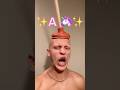 I’M A UNICORN! 🦄 #comedy #funny #lol #alopecia