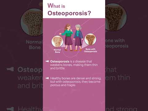 World Osteoporosis Day - October 20 | Dr.Ranvijay Pathak Orthopedic Surgeon