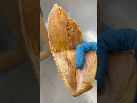 Real Human Achilles Tendon