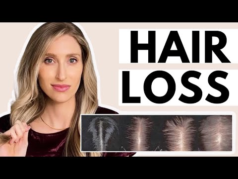 Hair Loss: Dermatologist Shares What Causes it & the...