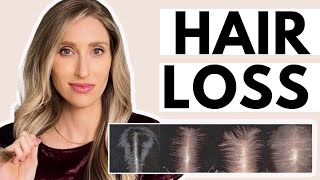 Hair Loss: Dermatologist Shares What Causes it & the Best Treatments (Minoxidil & More!)
