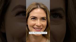 Botox For Wrinkles And Fine Lines at CARA