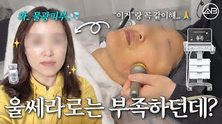 화제의 울쎄라 + 레스노베 시술 후기