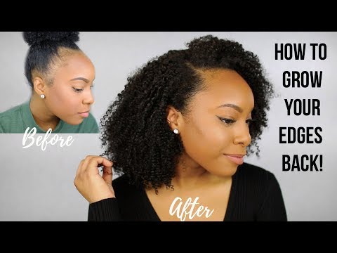 image-Can your edges grow back?