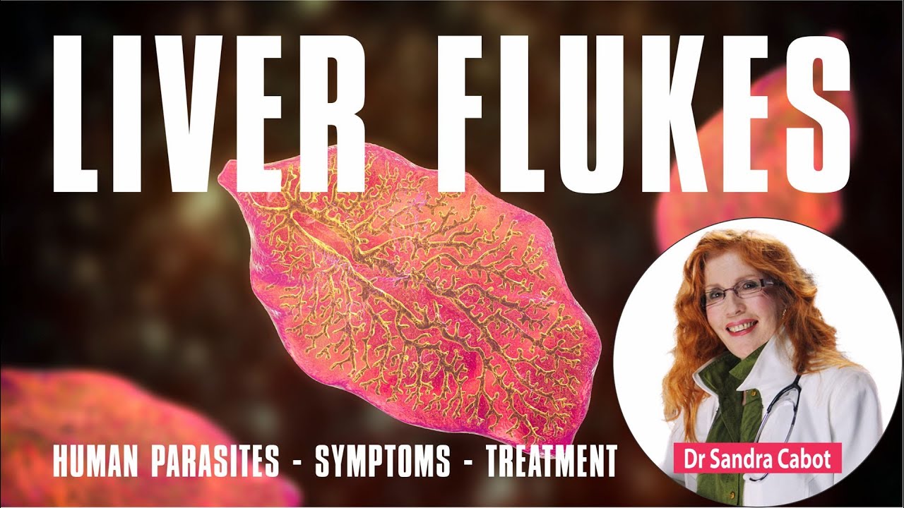 How do I know if I have liver flukes? – Life Set Go
