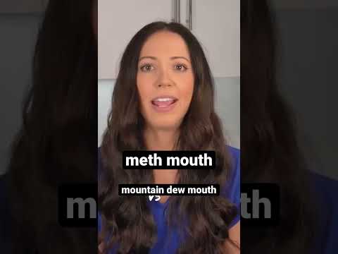meth mouth or mountain dew mouth? #shorts