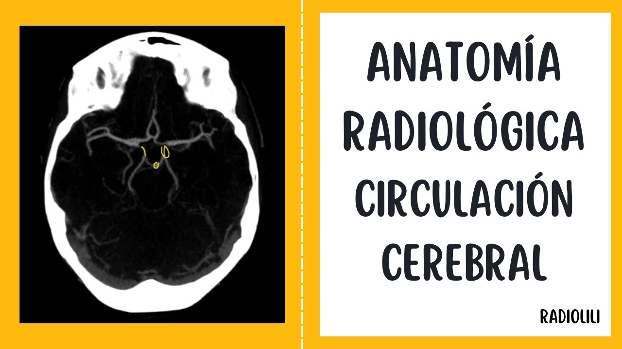 Anatomía Radiológica - Tomografía Computarizada: Circulación cerebral.