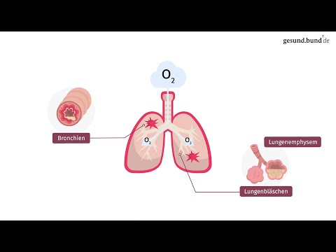 What is chronic obstructive pulmonary disease (COPD)?