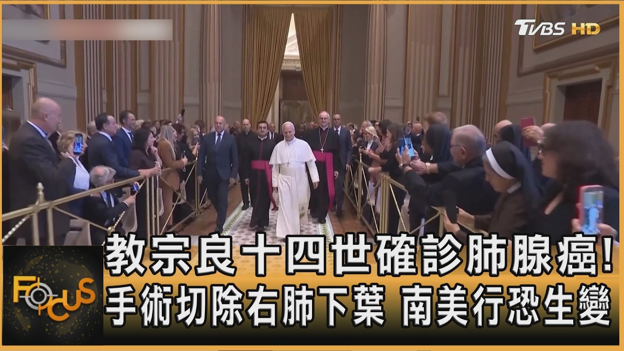 FOCUS全球新聞／教宗良十四世確診肺腺癌！手術切除右肺下葉　南美行恐生變