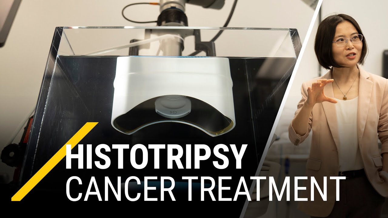 Histotripsy: Ultrasound cancer treatment approved by the FDA