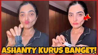 Download lagu ASHANTY KURUSAN, PIPI KEMPOT TUAI BANYAK SOROTAN NETIZEN 'JADI TAKUT LIATNYA' mp3 Download lagu ASHANTY KURUSAN, PIPI KEMPOT TUAI BANYAK SOROTAN NETIZEN 'JADI TAKUT LIATNYA' mp3