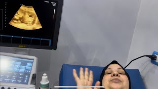 ام جني اخيرا رحنا للدكتور عشان نطمن علي البيبي ومطلعش بيبي طلع صغير زي امه وأخواته مفيش ????