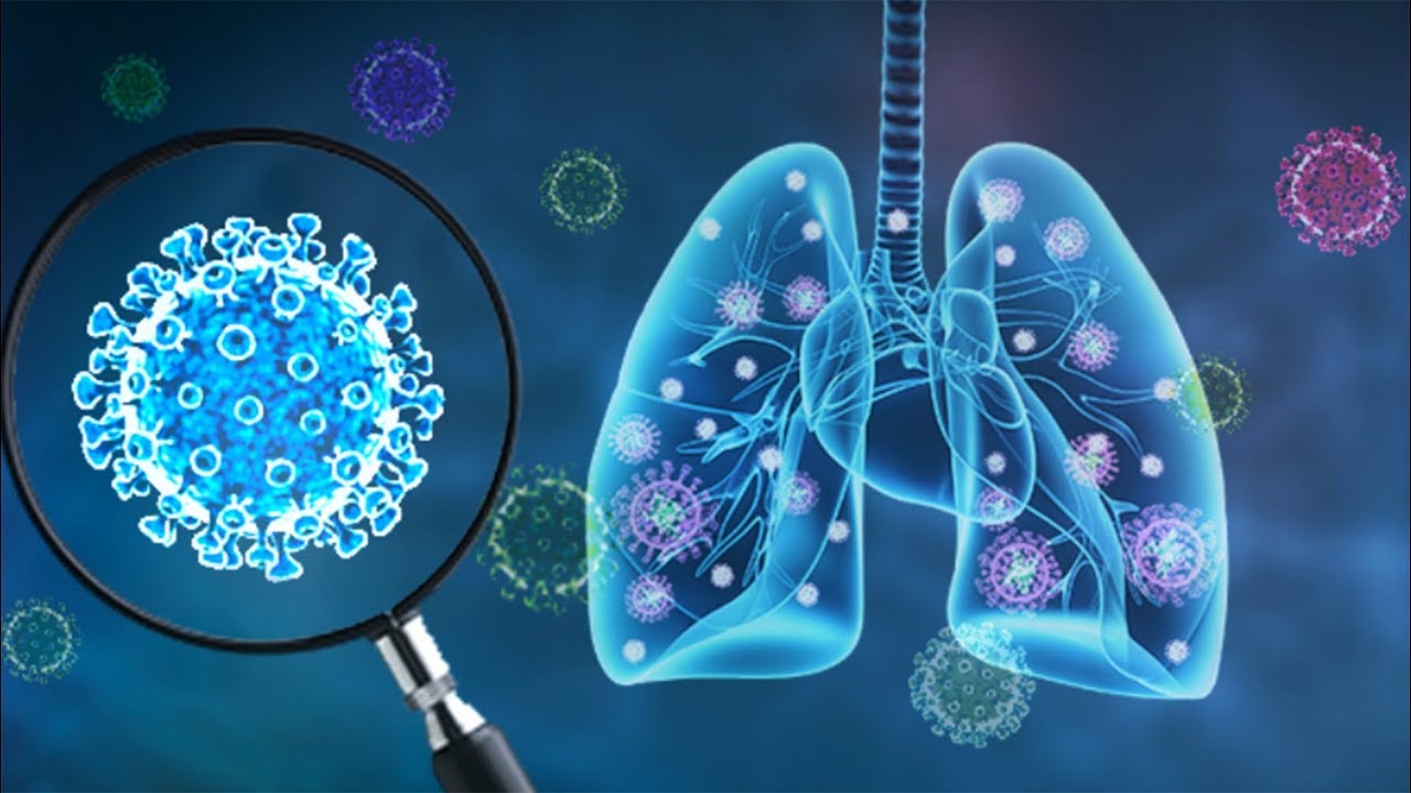 COVID-19: Developing nations matter