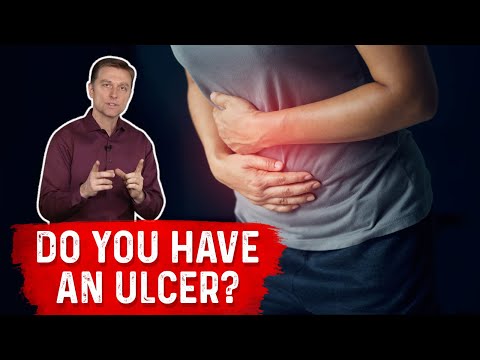Understanding Ulcers: How Do You Know If You Have One? – Dr. Berg