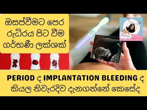 සුලු රුධිරය වහනයක් සිදුවන්නේ නම් ගර්භණී විය හැක. period or Implantation bleeding