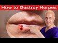 How To Destroy HERPES Dr Mandell