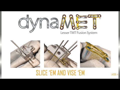 FootInnovate Panel Discussion - dynaMet™ System Introduction