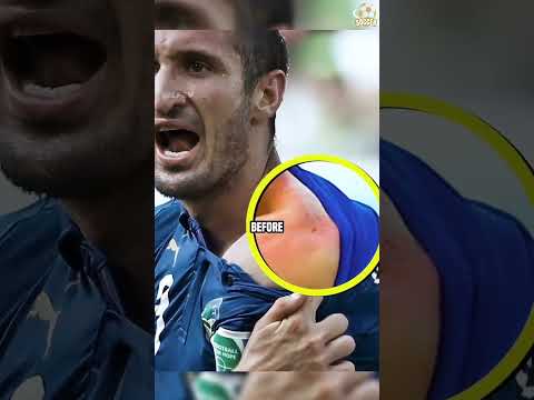 Suárez: The Vampire of Football🧛‍♂️