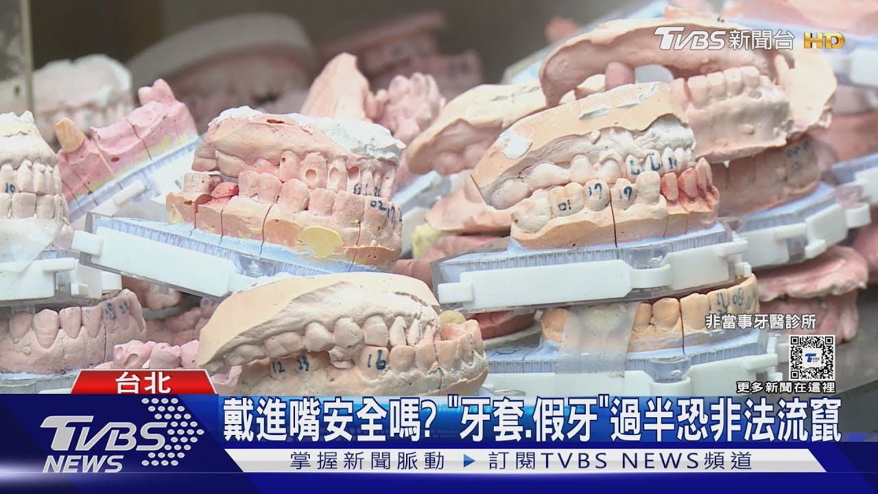 戴進嘴安全嗎? 「牙套、假牙」過半恐非法流竄