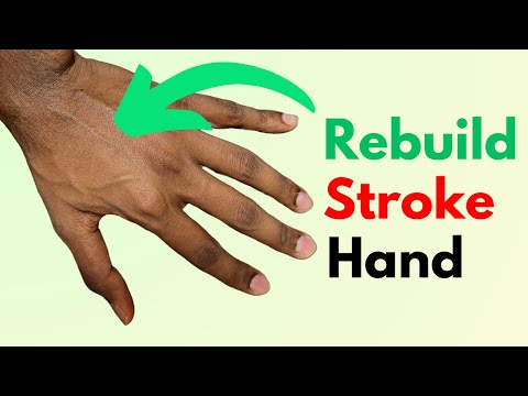 Stroke Recovery Hand Exercises: Regain Strength