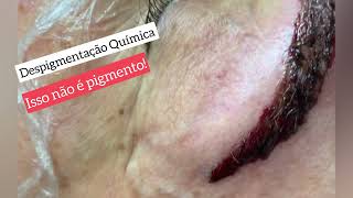 #despigmentaçao VOCÊ JÁ CAIU NESTA CILADA?? 🤔