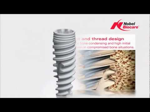 Nobel Replace Nobel Biocare Implant Systems