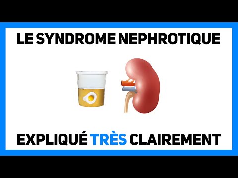 🔴 LE SYNDROME NÉPHROTIQUE EXPLIQUÉ TRÈS CLAIREMENT PAR DR ASTUCE