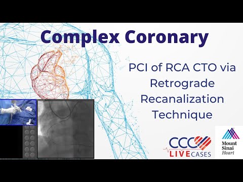 PCI of RCA CTO via Retrograde Recanilization Technique - CCC Live Sept 2016