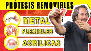 ✅ Tipos 𝗱𝗲 𝗣𝗥𝗢𝗧𝗘𝗦𝗜𝗦 𝗗𝗘𝗡𝗧𝗔𝗟𝗘𝗦 𝗥𝗘𝗠𝗢𝗩𝗜𝗕𝗟𝗘𝗦 : Ventajas e Inconvenientes ¿Que Dentadura Postiza es MEJOR