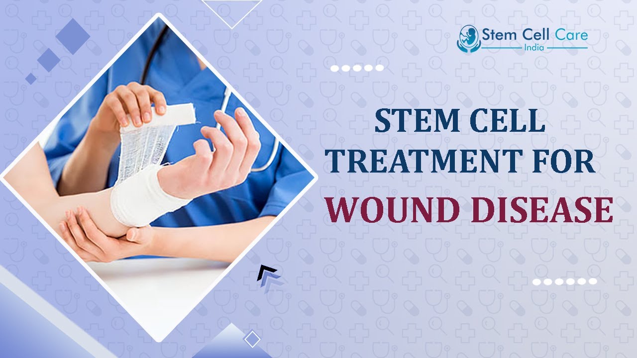 Best Treatment For Wound | Stem Cell Treatment For Wound | Best Stem Cell Center For Wound