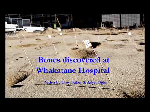 13/6/13 Bones at Whakatane Hospital