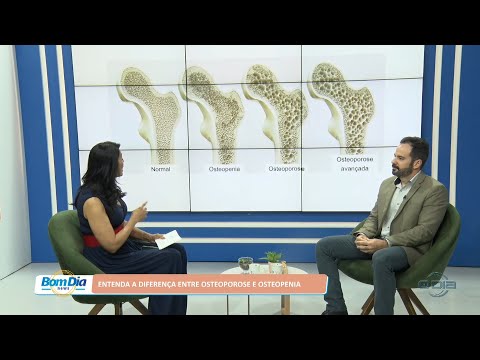 Médico explica diferença entre osteoporose e osteopenia 23 08 2022