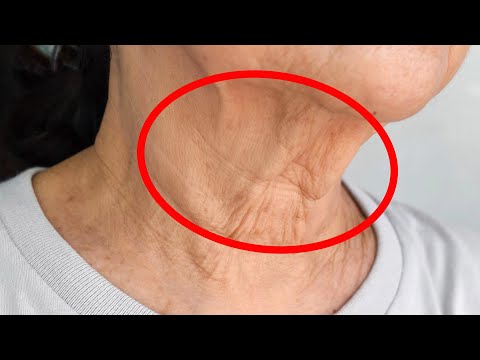 Tips for Preventing Signs of Aging Like ‘Turkey Neck’