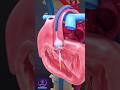 Heart Stent, Aortic Valve Repair with angioplasty #shorts #heartstent