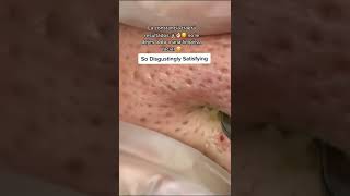 Que hacer después de una limpieza facial para mantener el efecto 👩🏻‍⚕️