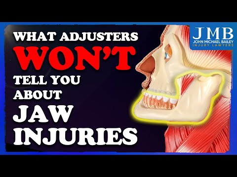 Hidden Injuries: What You Need To Know About Jaw Injuries