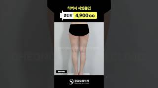 허벅지 전체, 깔끔하게 정리했다