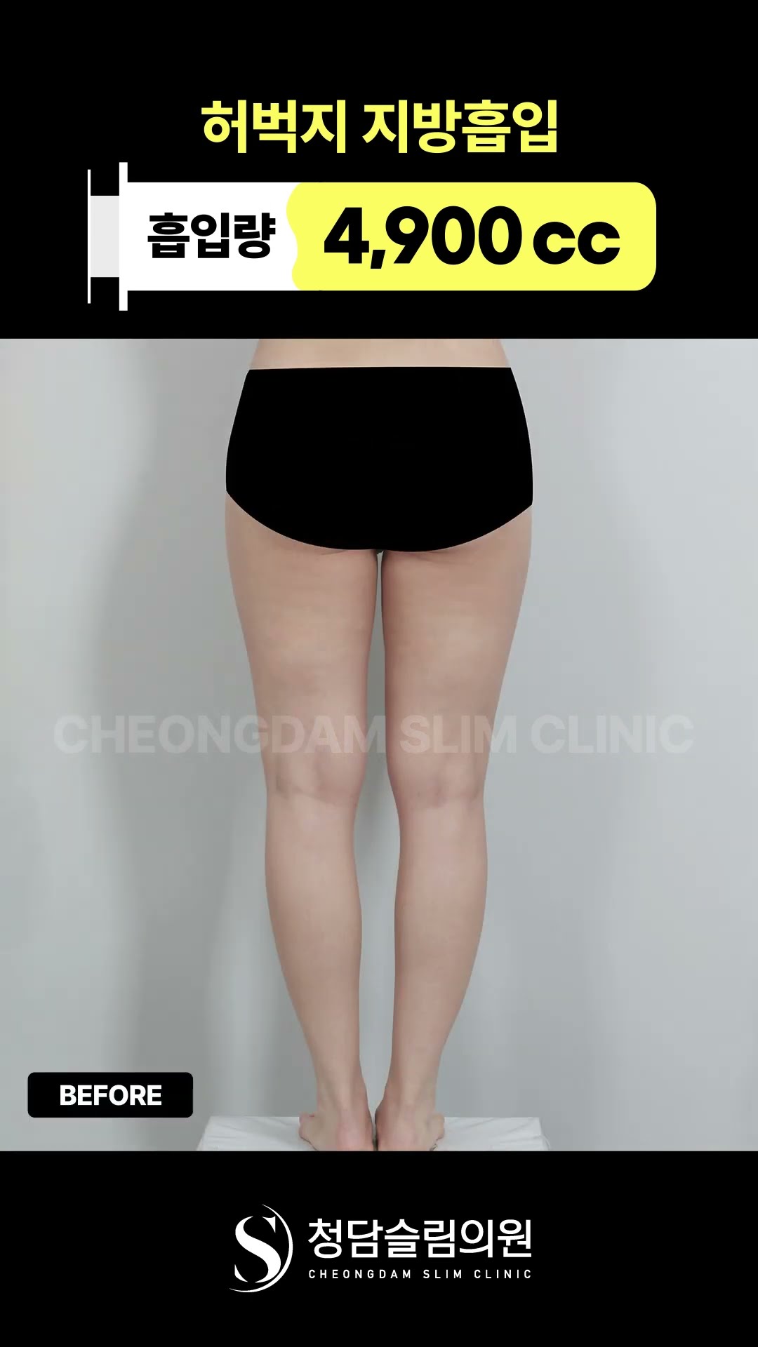 허벅지 전체, 깔끔하게 정리했다