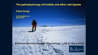 The pathophysiology of frostbite [GRAPHIC CONTENT]