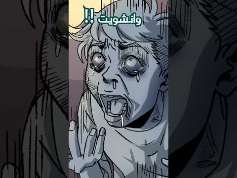 كان رح ينقطع اصبعي 😨 🔥