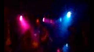 I&#39;m From Barcelona - Chicken Pox